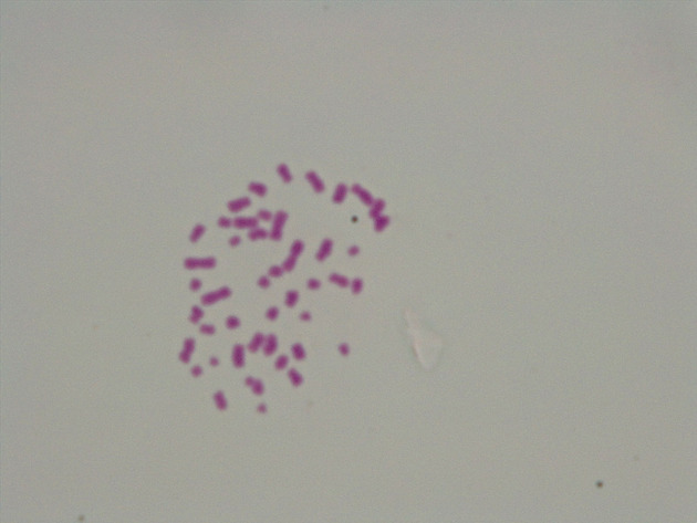 Female Chromosomes Slides - Female Chromosomes 10 1000X